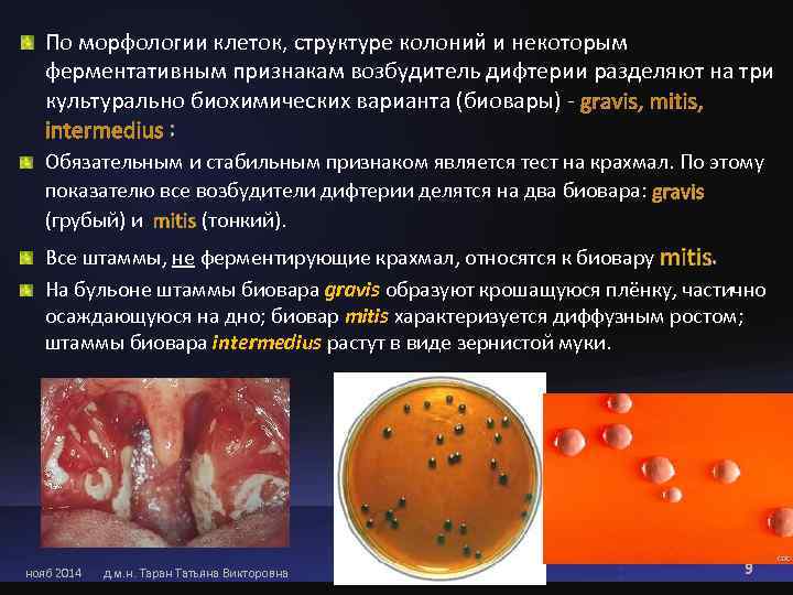   По морфологии клеток, структуре колоний и некоторым ферментативным признакам возбудитель дифтерии разделяют