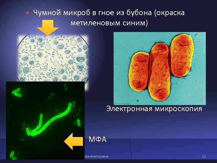 Чумной микроб в гное из бубона (окраска метиленовым синим) Чумной микроб в гное из бубона (окраска метиленовым синим)