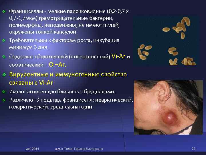 v Франциселлы - мелкие палочковидные (0, 2 -0, 7 х 0, 7 -1, v Франциселлы - мелкие палочковидные (0, 2 -0, 7 х 0, 7 -1,