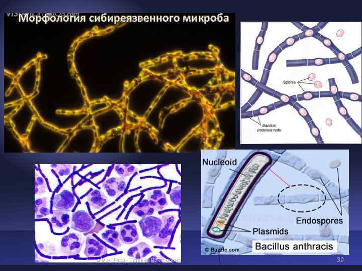 Морфология сибиреязвенного микроба дек 2014 д. м. н. Таран Татьяна Викторовна Морфология сибиреязвенного микроба дек 2014 д. м. н. Таран Татьяна Викторовна