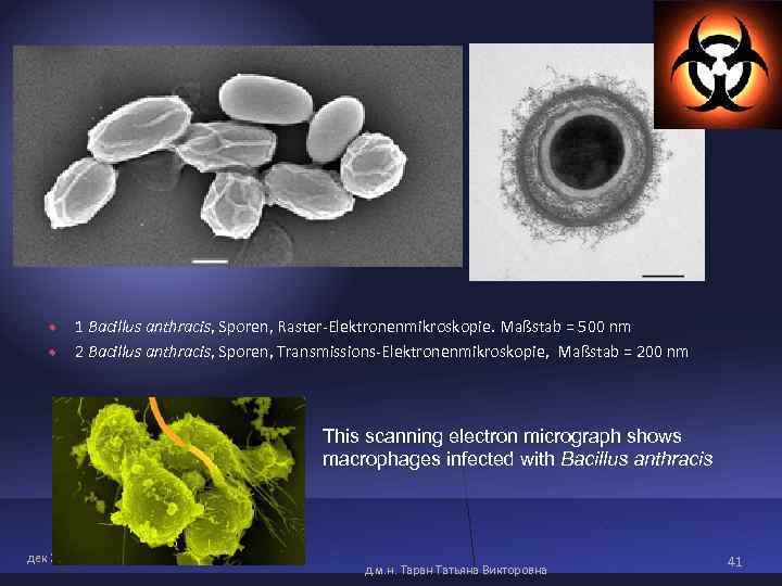 1 Bacillus anthracis, Sporen, Raster-Elektronenmikroskopie. Maßstab = 500 nm 2 Bacillus 1 Bacillus anthracis, Sporen, Raster-Elektronenmikroskopie. Maßstab = 500 nm 2 Bacillus