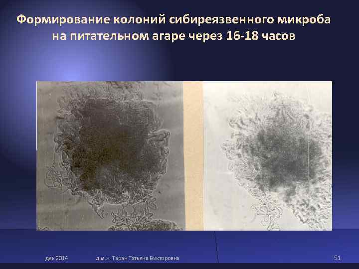 Формирование колоний сибиреязвенного микроба на питательном агаре через 16 -18 часов дек Формирование колоний сибиреязвенного микроба на питательном агаре через 16 -18 часов дек