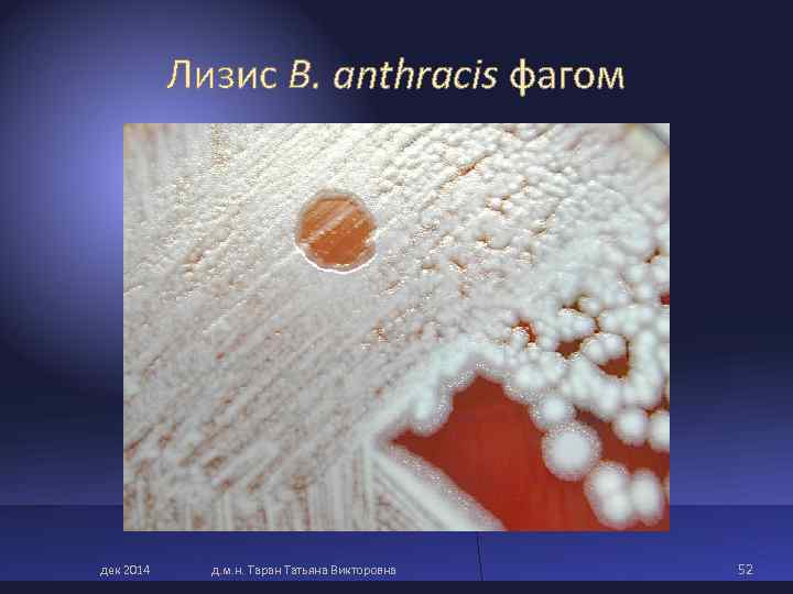 Лизис B. anthracis фагом дек 2014 д. м. н. Таран Татьяна Викторовна Лизис B. anthracis фагом дек 2014 д. м. н. Таран Татьяна Викторовна