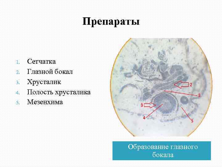     Препараты  1.  Сетчатка 2.  Глазной бокал 3.