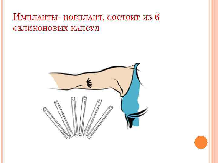 ИМПЛАНТЫ- НОРПЛАНТ, СОСТОИТ ИЗ 6 СЕЛИКОНОВЫХ КАПСУЛ 