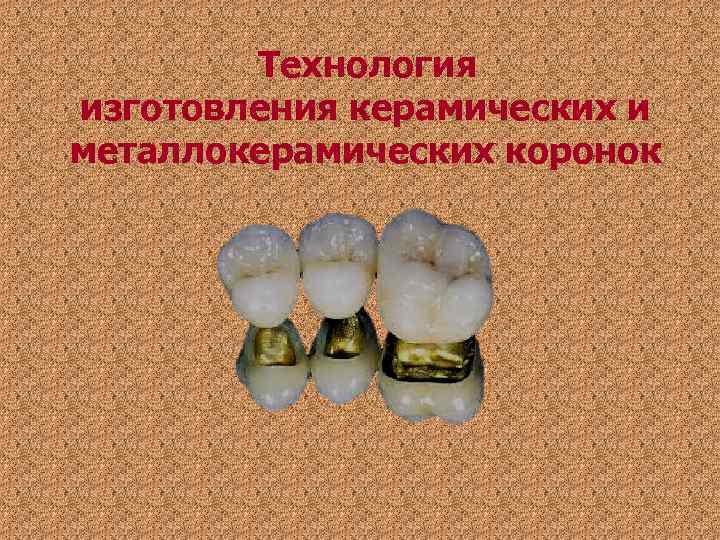 Технология изготовления керамических и металлокерамических коронок Технология изготовления керамических и металлокерамических коронок