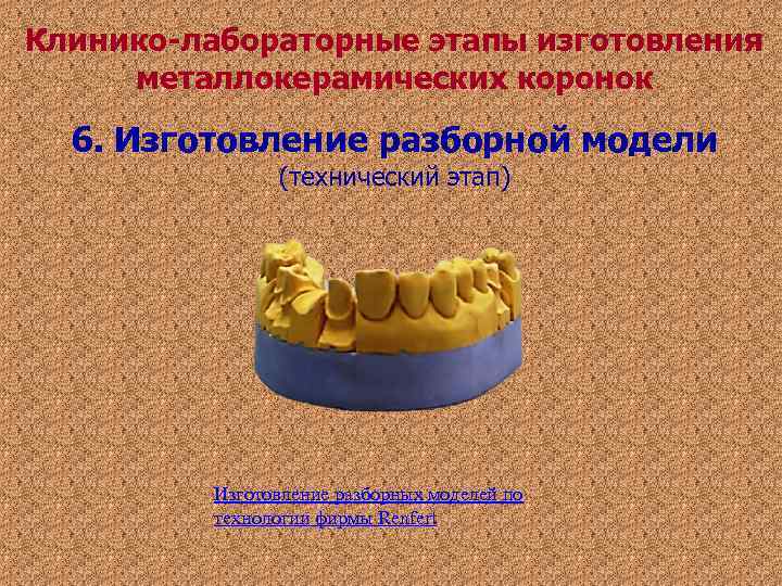 Клинико-лабораторные этапы изготовления металлокерамических коронок 6. Изготовление разборной модели (технический Клинико-лабораторные этапы изготовления металлокерамических коронок 6. Изготовление разборной модели (технический