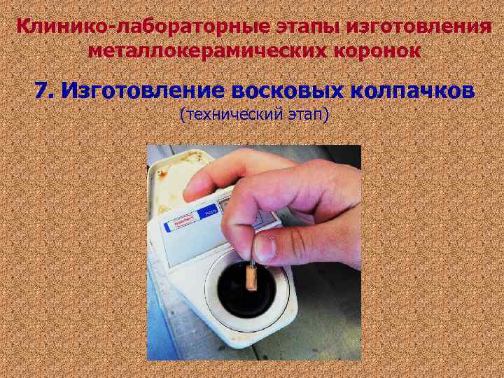 Клинико-лабораторные этапы изготовления металлокерамических коронок 7. Изготовление восковых колпачков (технический этап) Клинико-лабораторные этапы изготовления металлокерамических коронок 7. Изготовление восковых колпачков (технический этап)
