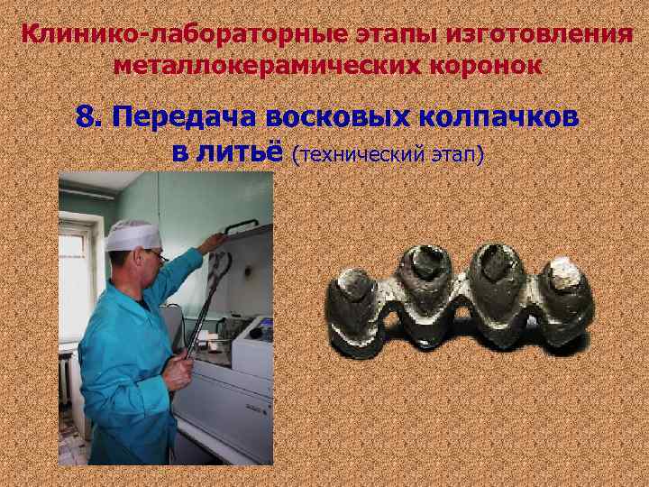 Клинико-лабораторные этапы изготовления металлокерамических коронок 8. Передача восковых колпачков в литьё (технический Клинико-лабораторные этапы изготовления металлокерамических коронок 8. Передача восковых колпачков в литьё (технический