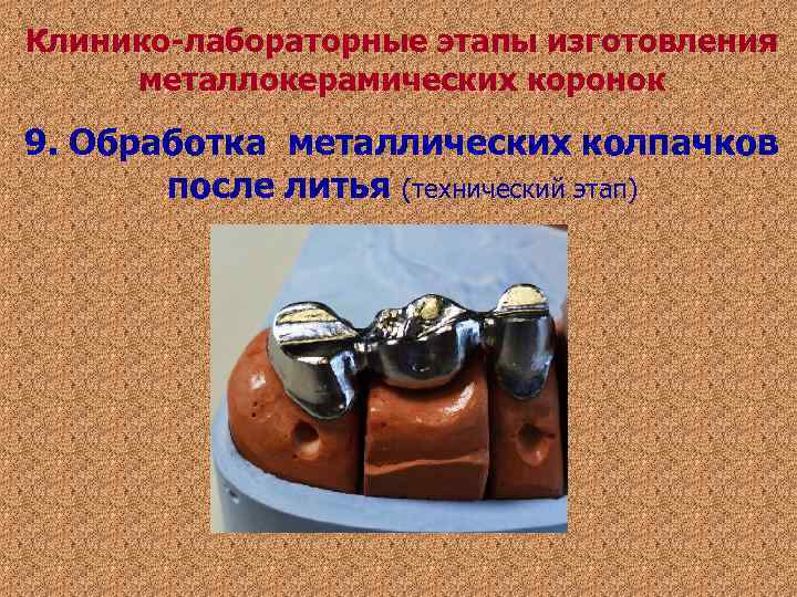 Клинико-лабораторные этапы изготовления металлокерамических коронок 9. Обработка металлических колпачков после литья (технический этап) Клинико-лабораторные этапы изготовления металлокерамических коронок 9. Обработка металлических колпачков после литья (технический этап)