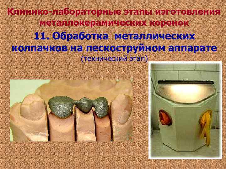 Клинико-лабораторные этапы изготовления металлокерамических коронок 11. Обработка металлических колпачков на пескоструйном аппарате Клинико-лабораторные этапы изготовления металлокерамических коронок 11. Обработка металлических колпачков на пескоструйном аппарате