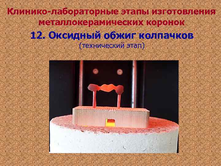 Клинико-лабораторные этапы изготовления металлокерамических коронок 12. Оксидный обжиг колпачков (технический этап) Клинико-лабораторные этапы изготовления металлокерамических коронок 12. Оксидный обжиг колпачков (технический этап)