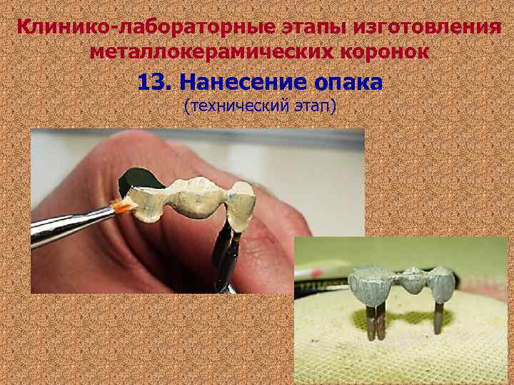 Клинико-лабораторные этапы изготовления металлокерамических коронок 13. Нанесение опака (технический этап) Клинико-лабораторные этапы изготовления металлокерамических коронок 13. Нанесение опака (технический этап)