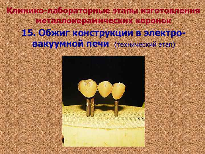 Клинико-лабораторные этапы изготовления металлокерамических коронок 15. Обжиг конструкции в электро- вакуумной печи (технический Клинико-лабораторные этапы изготовления металлокерамических коронок 15. Обжиг конструкции в электро- вакуумной печи (технический