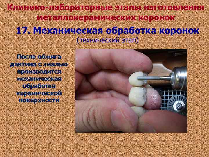 Клинико-лабораторные этапы изготовления металлокерамических коронок 17. Механическая обработка коронок (технический этап) Клинико-лабораторные этапы изготовления металлокерамических коронок 17. Механическая обработка коронок (технический этап)