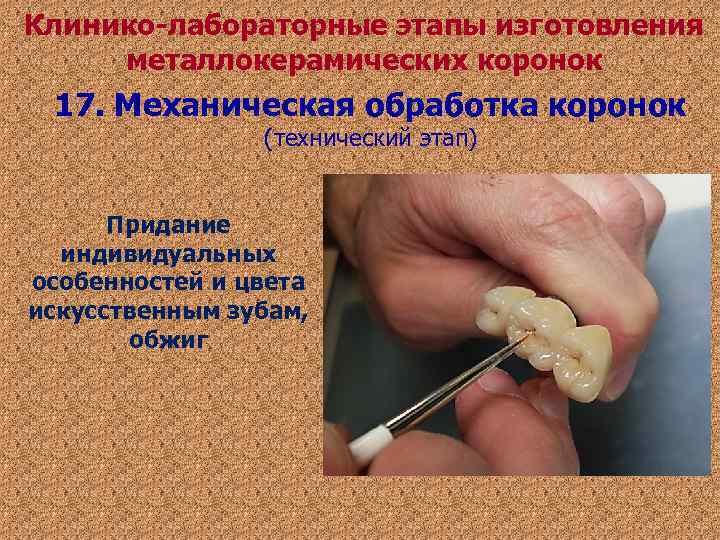 Клинико-лабораторные этапы изготовления металлокерамических коронок 17. Механическая обработка коронок (технический этап) Клинико-лабораторные этапы изготовления металлокерамических коронок 17. Механическая обработка коронок (технический этап)