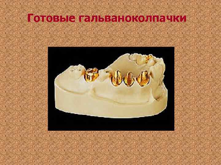 Готовые гальваноколпачки Готовые гальваноколпачки