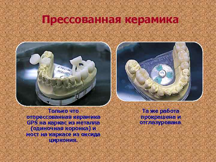 Прессованная керамика Только что Та же работа отпрессованная керамика прокрашена и Прессованная керамика Только что Та же работа отпрессованная керамика прокрашена и