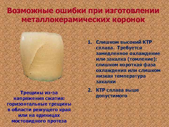 Возможные ошибки при изготовлении металлокерамических коронок 1. Слишком Возможные ошибки при изготовлении металлокерамических коронок 1. Слишком