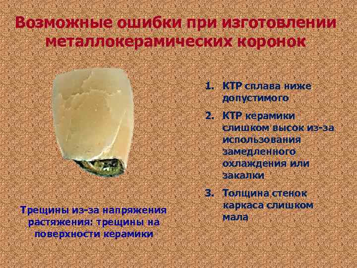 Возможные ошибки при изготовлении металлокерамических коронок 1. КТР сплава Возможные ошибки при изготовлении металлокерамических коронок 1. КТР сплава