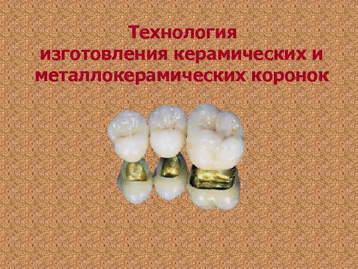 Технология изготовления керамических и металлокерамических коронок Технология изготовления керамических и металлокерамических коронок