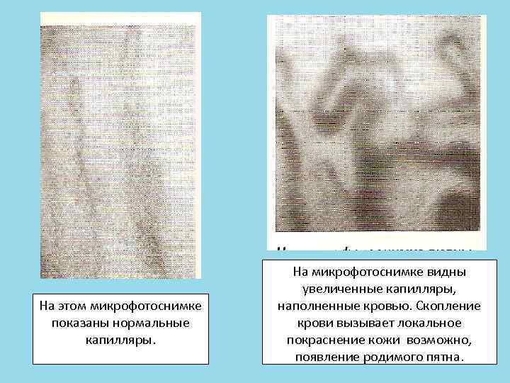      На микрофотоснимке видны      