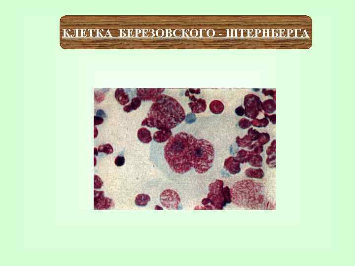 КЛЕТКА БЕРЕЗОВСКОГО - ШТЕРНБЕРГА 