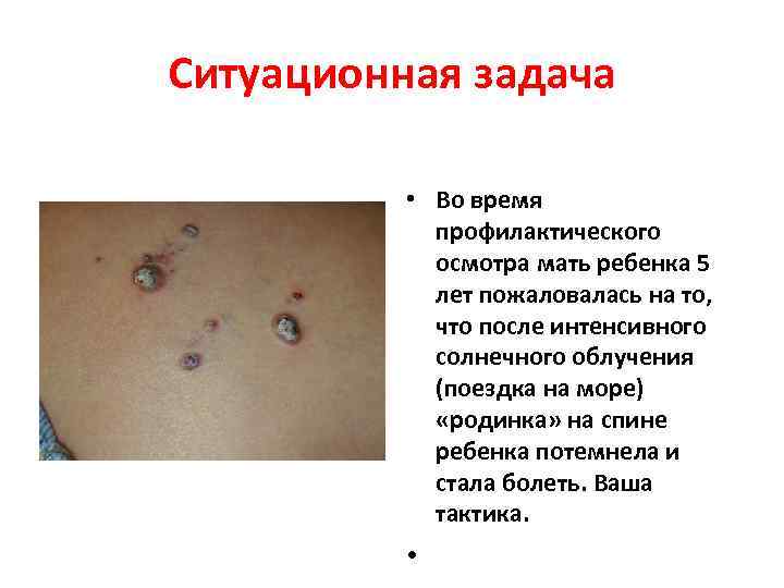 Ситуационная задача   • Во время   профилактического   осмотра мать