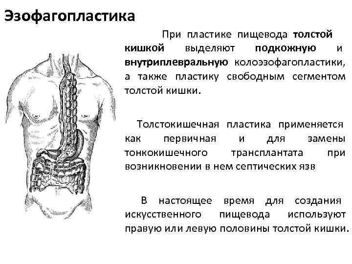 Операция герлока схема