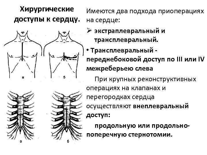 Поперечный распил грудной полости схема