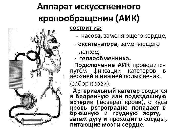 Искусственное кровообращение