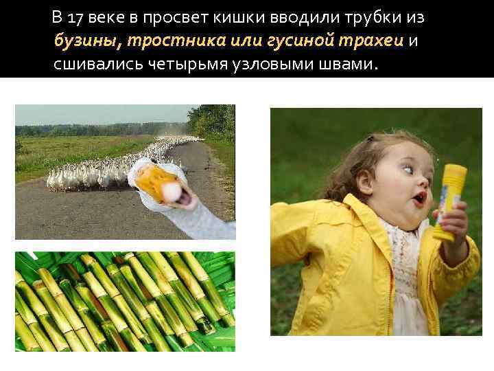 В 17 веке в просвет кишки вводили трубки из бузины, тростника или гусиной трахеи