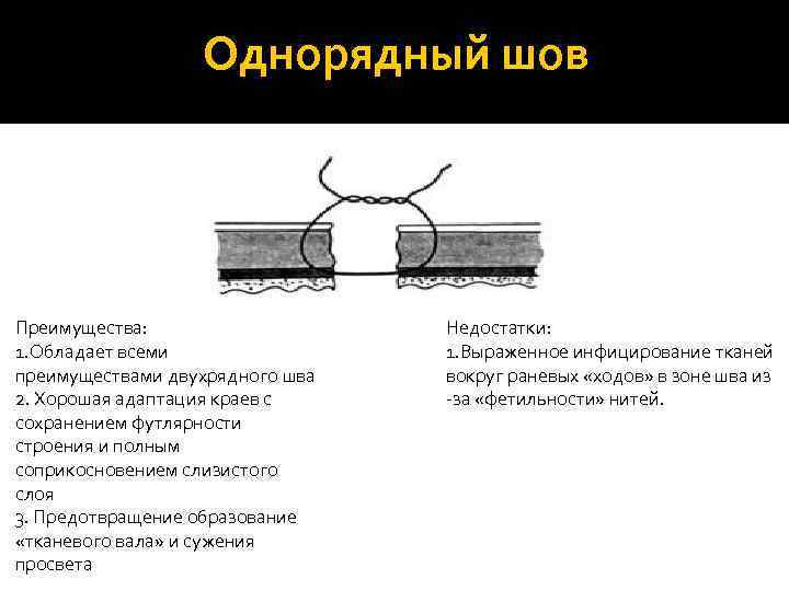    Однорядный шов Преимущества:     Недостатки: 1. Обладает всеми