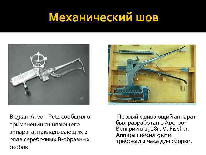    Механический шов В 1921 г A. von Petz сообщил о 