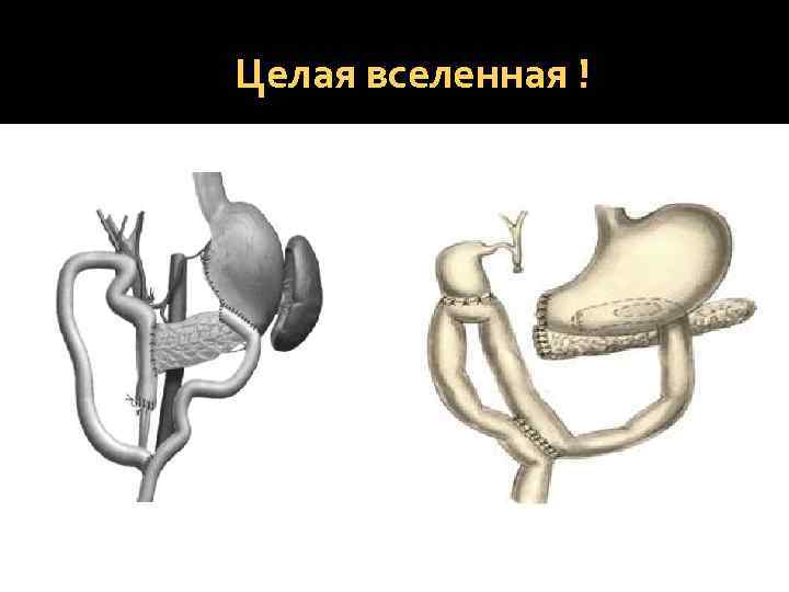 Целая вселенная ! 