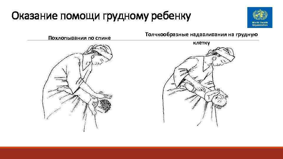 Оказание помощи грудному ребенку      Толчкообразные надавливания на грудную 