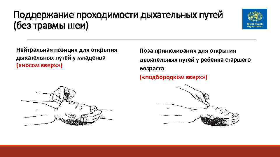 Поддержание проходимости дыхательных путей (без травмы шеи) Нейтральная позиция для открытия  Поза принюхивания