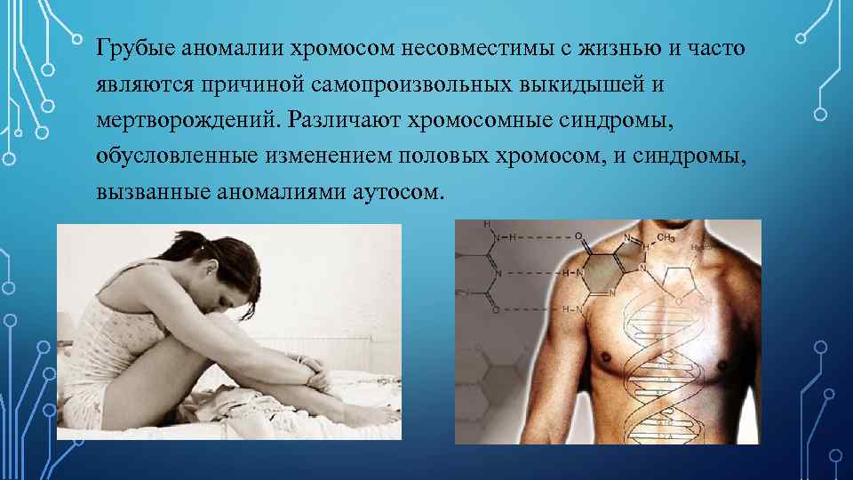 Грубые аномалии хромосом несовместимы с жизнью и часто являются причиной самопроизвольных выкидышей и мертворождений.