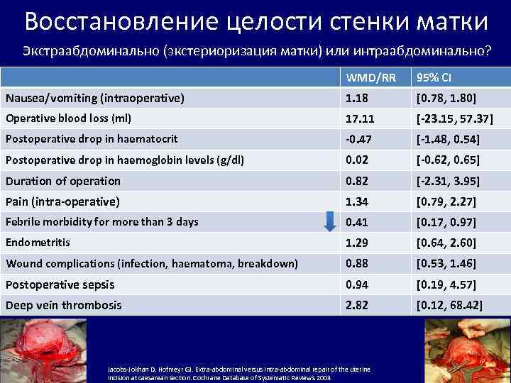 Восстановление целости стенки матки Экстраабдоминально (экстериоризация матки) или интраабдоминально? WMD/RR 95% CI Nausea/vomiting (intraoperative)