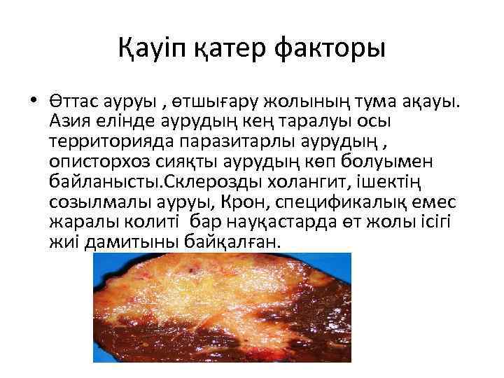    Қауіп қатер факторы • Өттас ауруы , өтшығару жолының тума ақауы.