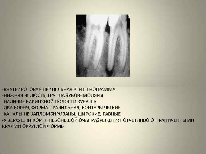 Методика выполнения прицельной рентгенографии зуба. Описание рентгенограммы зуба. Внутриротовая контактная (прицельная) рентгенография зубов. Опишите рентгенограмму зуба.