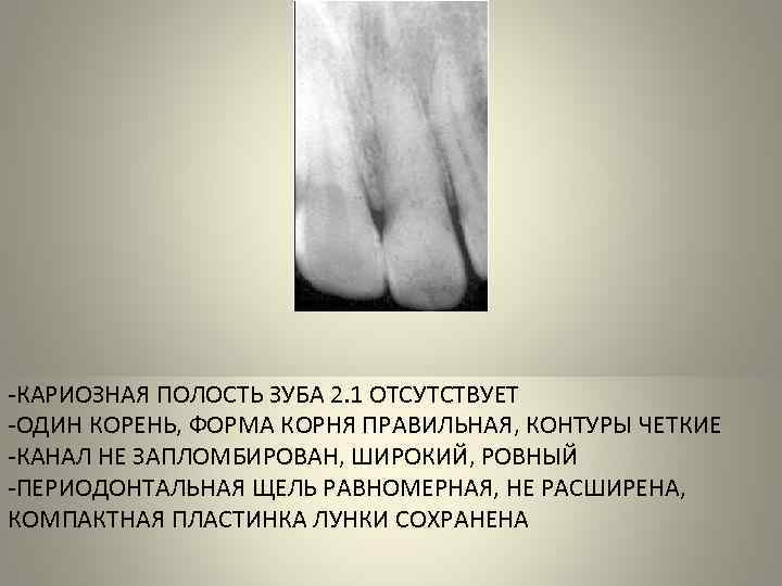 -ВНУТРИРОТОВАЯ ПРИЦЕЛЬНАЯ РЕНТГЕНОГРАММА -ВЕРХНЯЯ ЧЕЛЮСТЬ, ГРУППА ЗУБОВ- РЕЗЦЫ -КАРИОЗНАЯ ПОЛОСТЬ ЗУБА 2. 1 ОТСУТСТВУЕТ