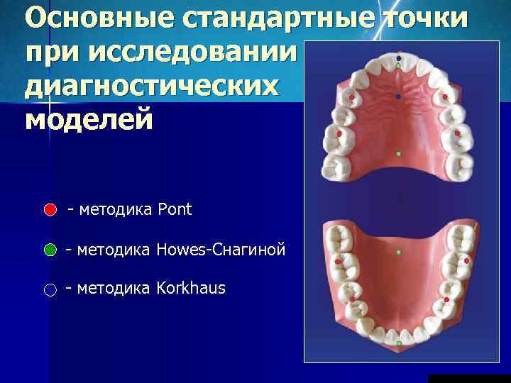 Основные стандартные точки при исследовании диагностических моделей - методика Pont  - методика Howes-Снагиной
