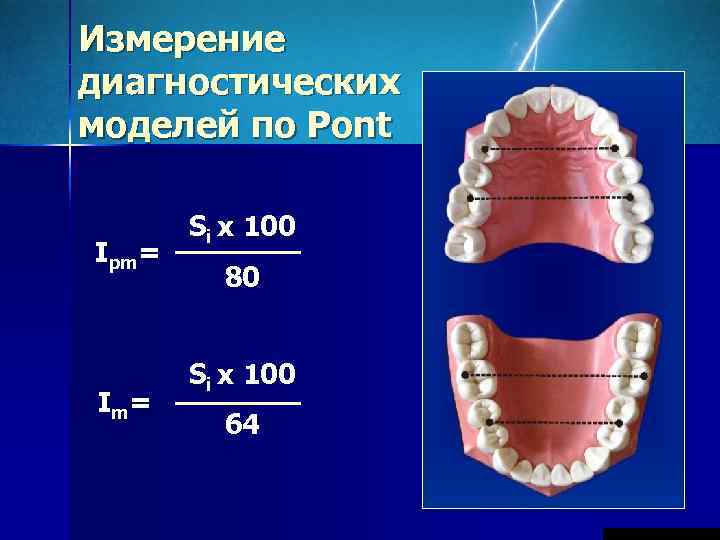 Измерение диагностических моделей по Pont   Si x 100 Ipm=   80