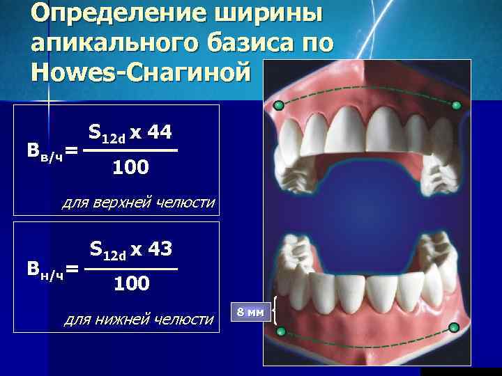 Определение ширины апикального базиса по Howes-Снагиной   S 12 d x 44 Bв/ч=