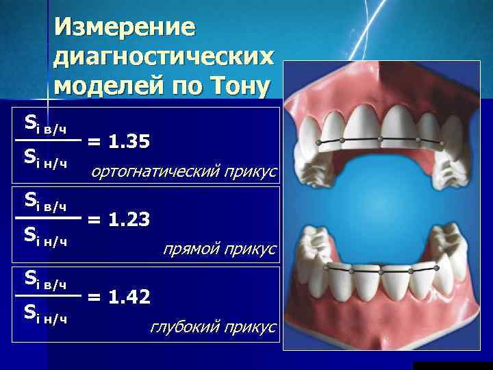   Измерение диагностических моделей по Тону Si в/ч   = 1. 35