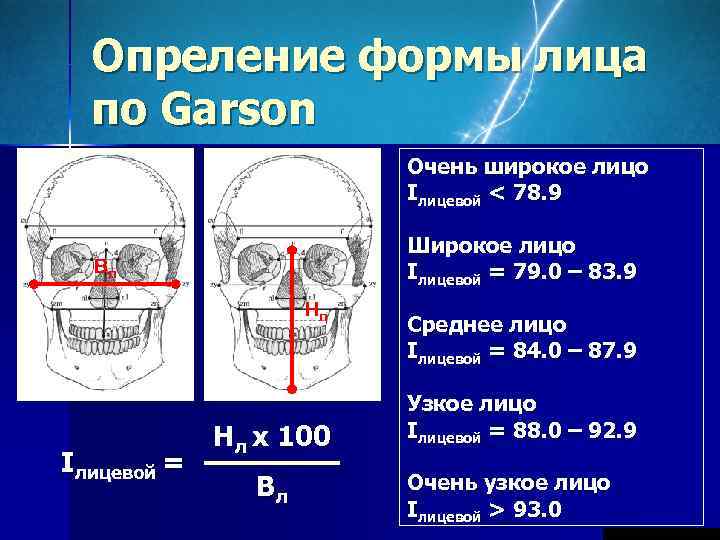  Опреление формы лица  по Garson     Очень широкое лицо