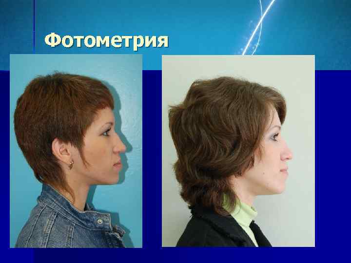 Фотометрия 