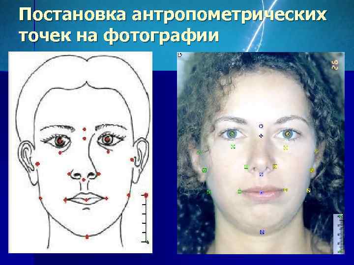 Постановка антропометрических точек на фотографии 