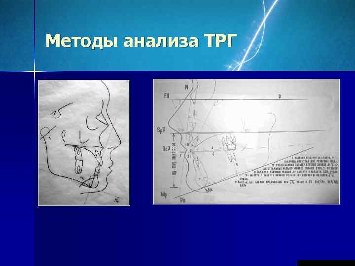 Методы анализа ТРГ 